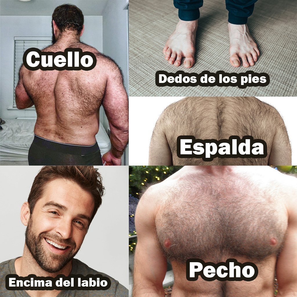 Zonas de bellos en hombres